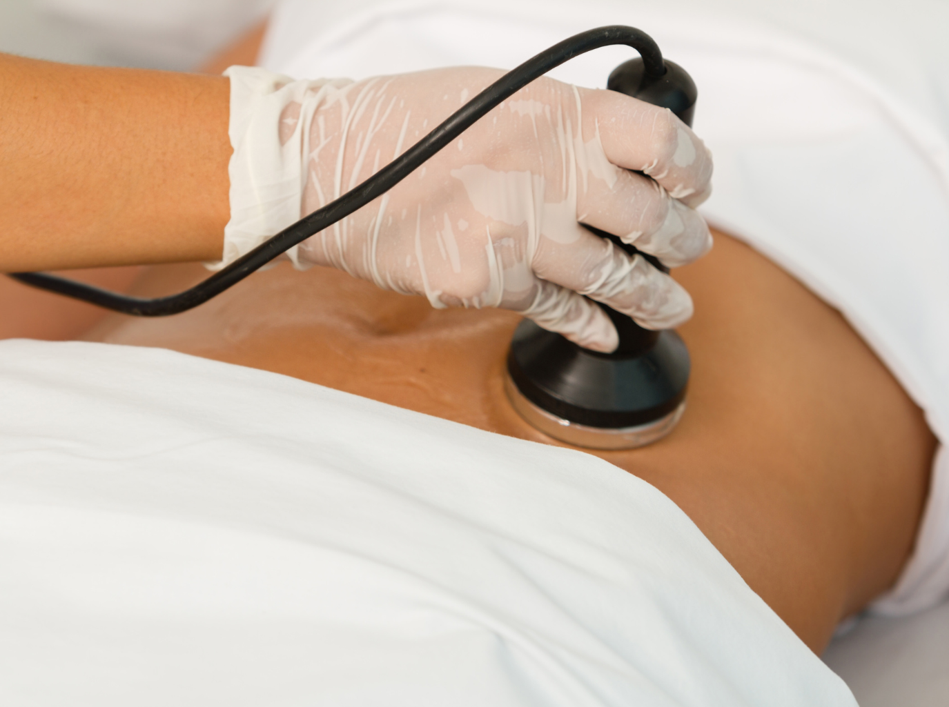 ULTRA CONTOUR, Ultrasound Cavitation /RFTraining