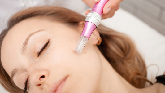 Microneedling