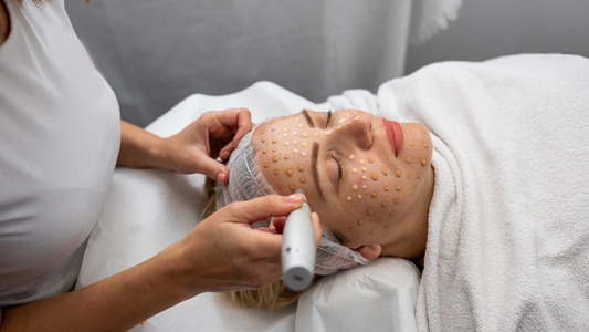 Microneedling BB Glow